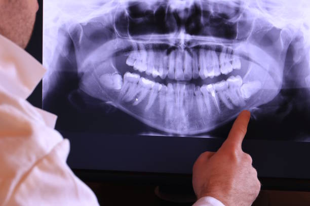 Best Emergency Broken Tooth Repair in Monticello, AR